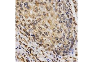 Immunohistochemistry (Paraffin-embedded Sections) (IHC (p)) image for anti-Histone 3 (H3) (H3K9me3) antibody (ABIN3016030)
