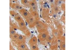 Used in DAB staining on fromalin fixed paraffin-embedded liver tissue (TOR1A 抗体  (AA 41-333))