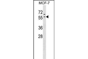 ZN Antibody (N-term) (ABIN1538932 and ABIN2849449) western blot analysis in MCF-7 cell line lysates (35 μg/lane). (ZNF383 抗体  (N-Term))