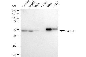 Western blotting analysis using TGF beta 1 antibody (ABIN7800605).