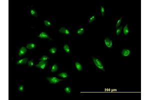 Immunofluorescence of purified MaxPab antibody to GORASP2 on HeLa cell. (GORASP2 抗体  (AA 1-452))