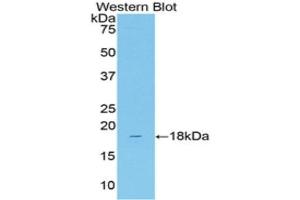 Western Blotting (WB) image for anti-Solute Carrier Family 12 (Sodium/Chloride Transporters), Member 3 (SLC12A3) (AA 3-146) antibody (ABIN2118607) (SLC12A3 抗体  (AA 3-146))