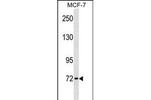 CPT2 Antibody (Center) (ABIN1881226 and ABIN2838883) western blot analysis in MCF-7 cell line lysates (35 μg/lane). (CPT2 抗体  (AA 212-241))