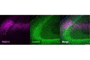 Coronal section from a C57BL/6J mouse showing the hippocampus co-stainedwith RGS14 (cat. (RGS14 抗体  (AA 1-544))