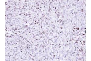 IHC-P Image Immunohistochemical analysis of paraffin-embedded H3347 xenograft , using ZNF707, antibody at 1:500 dilution. (ZNF707 抗体)