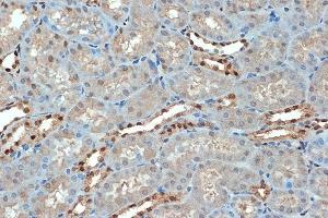 Immunohistochemistry of paraffin-embedded mouse kidney using SUMO4 Rabbit mAb (ABIN7270372) at dilution of 1:100 (40x lens). (SUMO4 抗体)