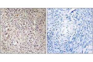 Immunohistochemistry analysis of paraffin-embedded human ovary tissue, using GCNT7 Antibody. (GCNT7 抗体  (AA 311-360))
