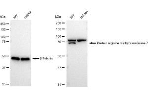 Western blotting analysis using Protein arginine methyltransferase 7 antibody (ABIN7799973). (Recombinant PRMT7 抗体)
