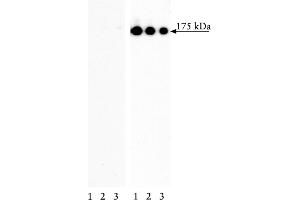 Western Blotting (WB) image for anti-Epidermal Growth Factor Receptor (EGFR) (pTyr845) antibody (ABIN967602)