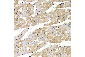 Immunohistochemistry of paraffin-embedded rat heart using FIS1 Antibody. (Fission 1 抗体  (AA 1-122))