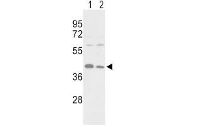Western Blotting (WB) image for anti-Phosphoglycerate Kinase 1 (PGK1) antibody (ABIN3002985) (PGK1 抗体)