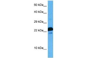 Host:  Rat  Target Name:  MAFG  Sample Tissue:  Rat Skeletal Muscle  Antibody Dilution:  1ug/ml (Mafg 抗体  (N-Term))