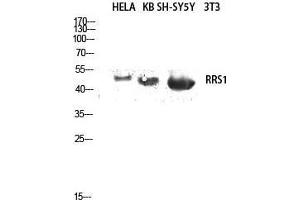 Western Blot (WB) analysis of HeLa, KB, SH-SY5Y lysis using RRS1 antibody. (RRS1 抗体  (Internal Region))