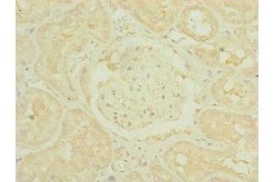 Immunohistochemistry of paraffin-embedded human kidney tissue using ABIN7159887 at dilution of 1:100 (TIMM1B (AA 1-103) 抗体)
