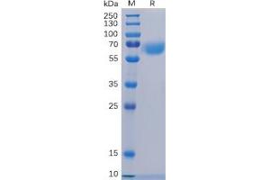 Human CD48 Protein, hFc Tag on SDS-PAGE under reducing condition. (CD48 Protein (CD48) (Fc Tag))