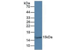 Detection of GAL7 in Rat Skin Tissue using Monoclonal Antibody to Galectin 7 (GAL7) (LGALS7 抗体  (AA 1-136))