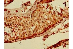 Immunohistochemistry of paraffin-embedded human testis tissue using ABIN7169019 at dilution of 1:100 (BRSK1 抗体  (AA 426-591))