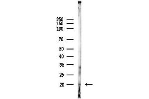 Western blot analysis of lysates from Mouse testis, using Phospho-4E-BP1 (Ser65/Thr70) Antibody at 1/1000 dilution.