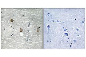 Immunohistochemical analysis of paraffin-embedded human brain tissue using TOB1 (Phospho-Ser164) antibody (left)or the same antibody preincubated with blocking peptide (right). (Protein Tob1 (TOB1) (pSer164) 抗体)