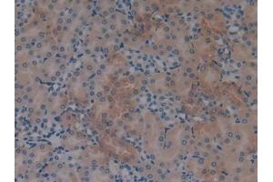 Detection of S100A6 in Mouse Kidney Tissue using Monoclonal Antibody to S100 Calcium Binding Protein A6 (S100A6) (S100A6 抗体  (AA 1-89))