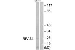Western blot analysis of extracts from MCF-7 cells, using RPAB1 Antibody. (POLR2E 抗体  (AA 21-70))