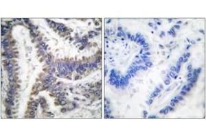 Immunohistochemistry (IHC) image for anti-DNA Fragmentation Factor, 45kDa, alpha Polypeptide (DFFA) (AA 175-224), (Cleaved-Asp224) antibody (ABIN2891161) (DFFA 抗体  (Cleaved-Asp224))