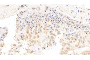 Detection of SELP in Human Placenta Tissue using Monoclonal Antibody to P-Selectin (SELP)