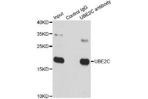 Immunoprecipitation analysis of 150 μg extracts of SW620 cells using 3 μg UBE2C antibody (ABIN5973207). (UBE2C 抗体)