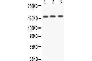 Anti- ACE antibody,  Western blotting All lanes: Anti ACE () at 0. (Angiotensin I Converting Enzyme 1 抗体  (Middle Region))