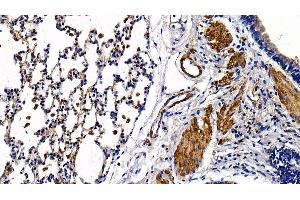 Detection of TLR5 in Rat Lung Tissue using Polyclonal Antibody to Toll Like Receptor 5 (TLR5) (TLR5 抗体  (AA 325-644))