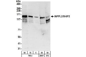 Western Blotting (WB) image for anti-Inositol Polyphosphate Phosphatase-Like 1 (INPPL1) (AA 100-150) antibody (ABIN7454647)