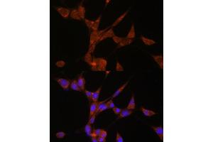 Immunofluorescence analysis of NIH/3T3 cells using C3 antibody (ABIN3022535, ABIN3022536, ABIN3022537 and ABIN6218888) at dilution of 1:100.
