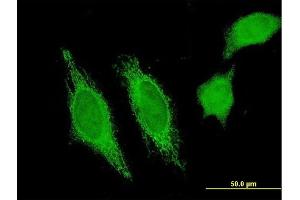 Immunofluorescence of monoclonal antibody to HHLA3 on HeLa cell. (HHLA3 抗体  (AA 1-53))