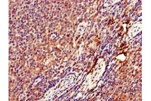 Immunohistochemistry of paraffin-embedded human lymph node tissue using ABIN7149671 at dilution of 1:100 (DENND1C 抗体  (AA 601-801))