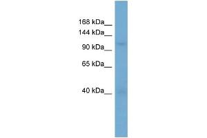 WB Suggested Anti-RANBP5  Antibody Titration: 0. (Importin 5 抗体  (N-Term))