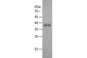 Western Blotting (WB) image for Neuroblastoma 1, DAN Family BMP Antagonist (NBL1) (AA 17-181) protein (His-IF2DI Tag) (ABIN7124146) (NBL1 Protein (AA 17-181) (His-IF2DI Tag))
