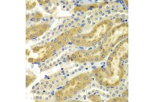 Immunohistochemistry of paraffin-embedded mouse kidney using PAK2 antibody (ABIN5975499) at dilution of 1/100 (40x lens).