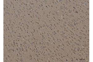 IHC analysis of Calnexin/CANX using anti-Calnexin/CANX antibody (ABIN7602289). (Calnexin 抗体  (AA 68-582))