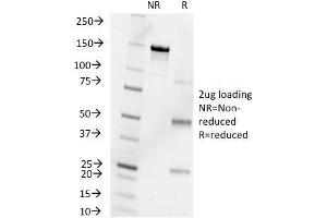 SDS-PAGE Analysis Purified Progesterone Mouse Monoclonal Antibody (6-5E-10B). (Progesterone 抗体)