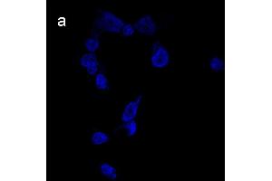 Detection of cathepsin B (CB) activity in Eca-109 cells by the CB probe.