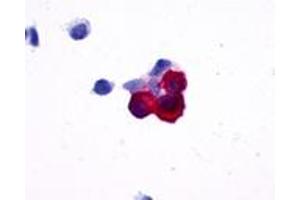 Anti-NPY5R antibody immunocytochemistry (ICC) staining of HEK293 human embryonic kidney cells transfected with NPY5R. (NPY5R 抗体  (Cytoplasmic Domain))