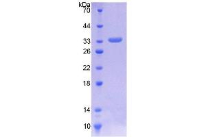 SDS-PAGE analysis of Human ILK Protein. (ILK 蛋白)