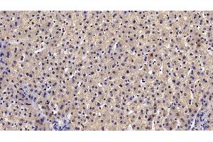Immunohistochemistry (IHC) image for anti-Complement Component C4b (C4b) (AA 680-756) antibody (ABIN7433420)