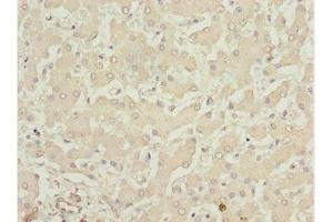 Immunohistochemistry of paraffin-embedded human liver tissue using ABIN7158391 at dilution of 1:100 (LHX6 抗体  (AA 114-363))