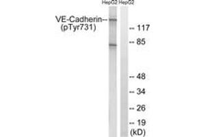 Western blot analysis of extracts from HepG2 cells treated with Na3VO4 0. (Cadherin 5 抗体  (pTyr731))