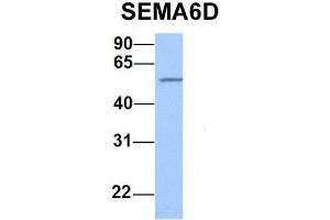 Western Blotting (WB) image for anti-Sema Domain, Transmembrane Domain (TM), and Cytoplasmic Domain, (Semaphorin) 6D (SEMA6D) (N-Term) antibody (ABIN2783810)