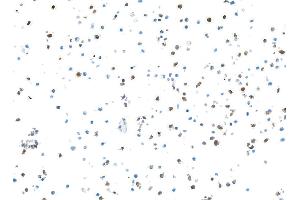 Immunocytochemistry (ICC) image for anti-S100 Calcium Binding Protein A9 (S100A9) (AA 64-114) antibody (ABIN7449432) (Recombinant S100A9 抗体  (AA 64-114))
