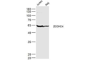 Lane 1: jurkat lysates Lane 2: raji lysates probed with ZCCHC4 Polyclonal Antibody, Unconjugated  at 1:300 dilution and 4˚C overnight incubation. (ZCCHC4 抗体  (AA 301-400))