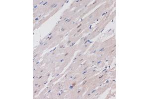 Immunohistochemistry (IHC) image for anti-AT Rich Interactive Domain 1B (SWI1-Like) (ARID1B) (AA 400-650) antibody (ABIN7265702)
