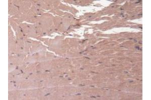 Detection of HMWK in Mouse Skeletal Muscle Tissue using Polyclonal Antibody to High Molecular Weight Kininogen (HMWK) (Kininogen (HMW) 抗体  (AA 268-540))